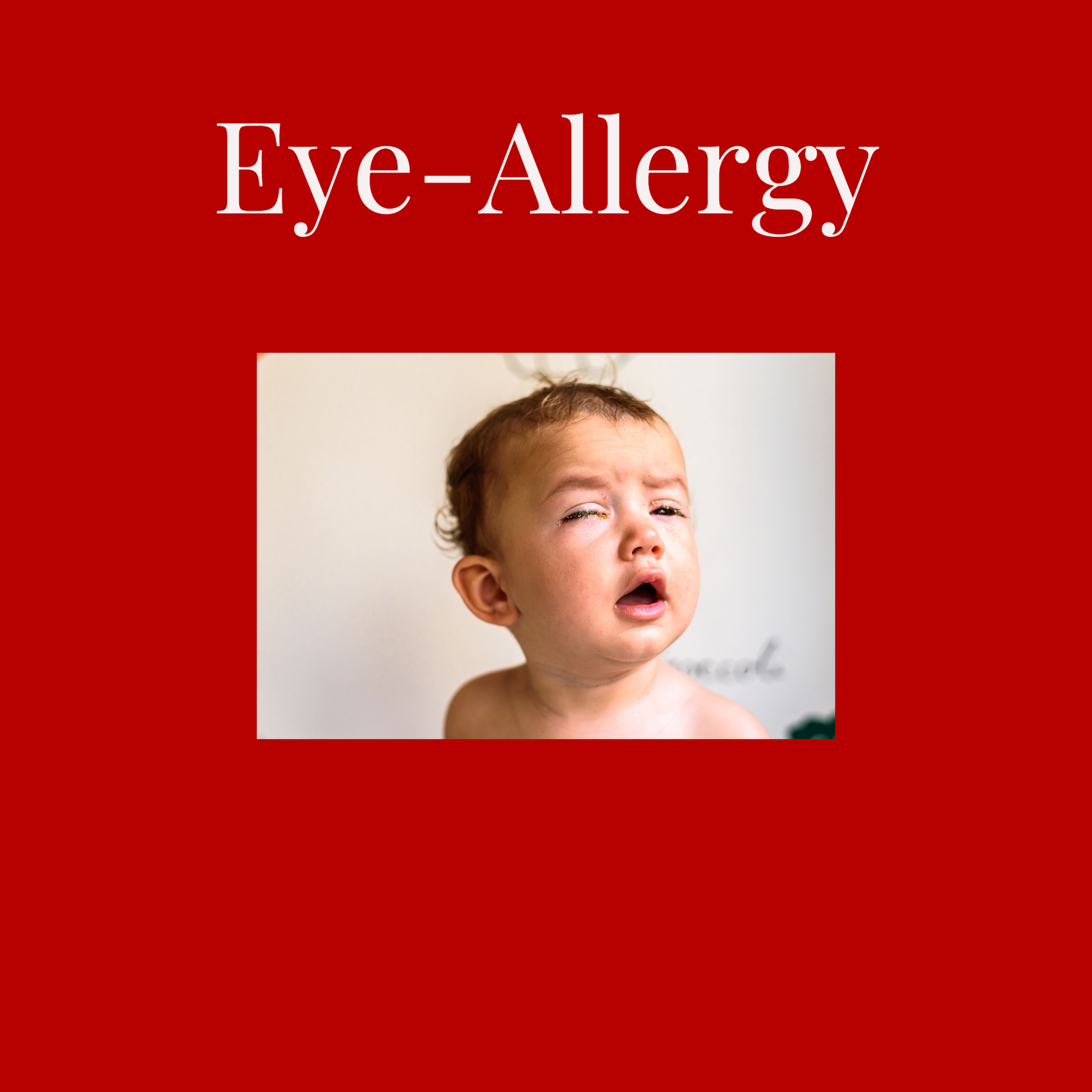 Eye – Allergy