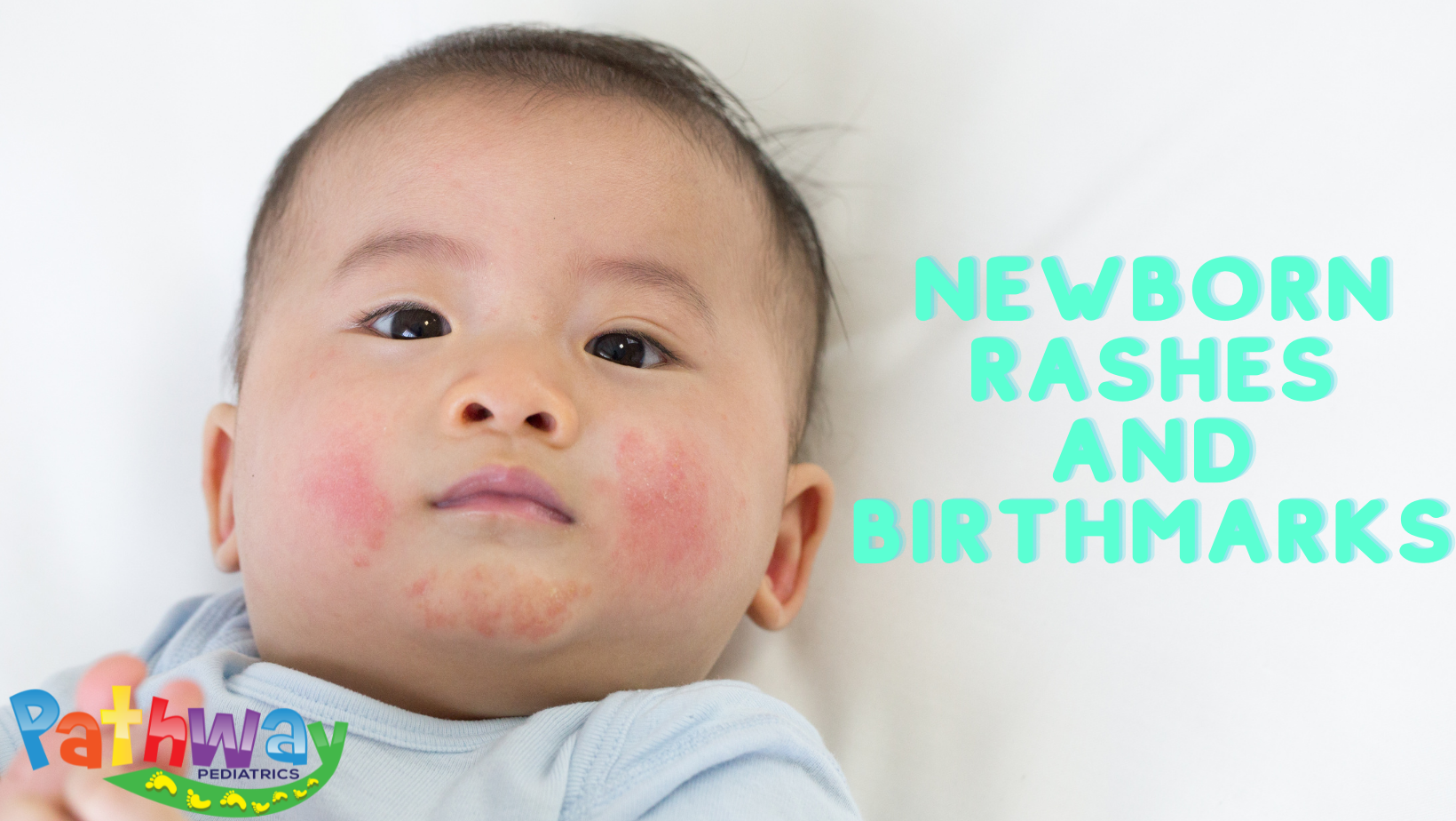 Newborn Rashes and Birthmarks